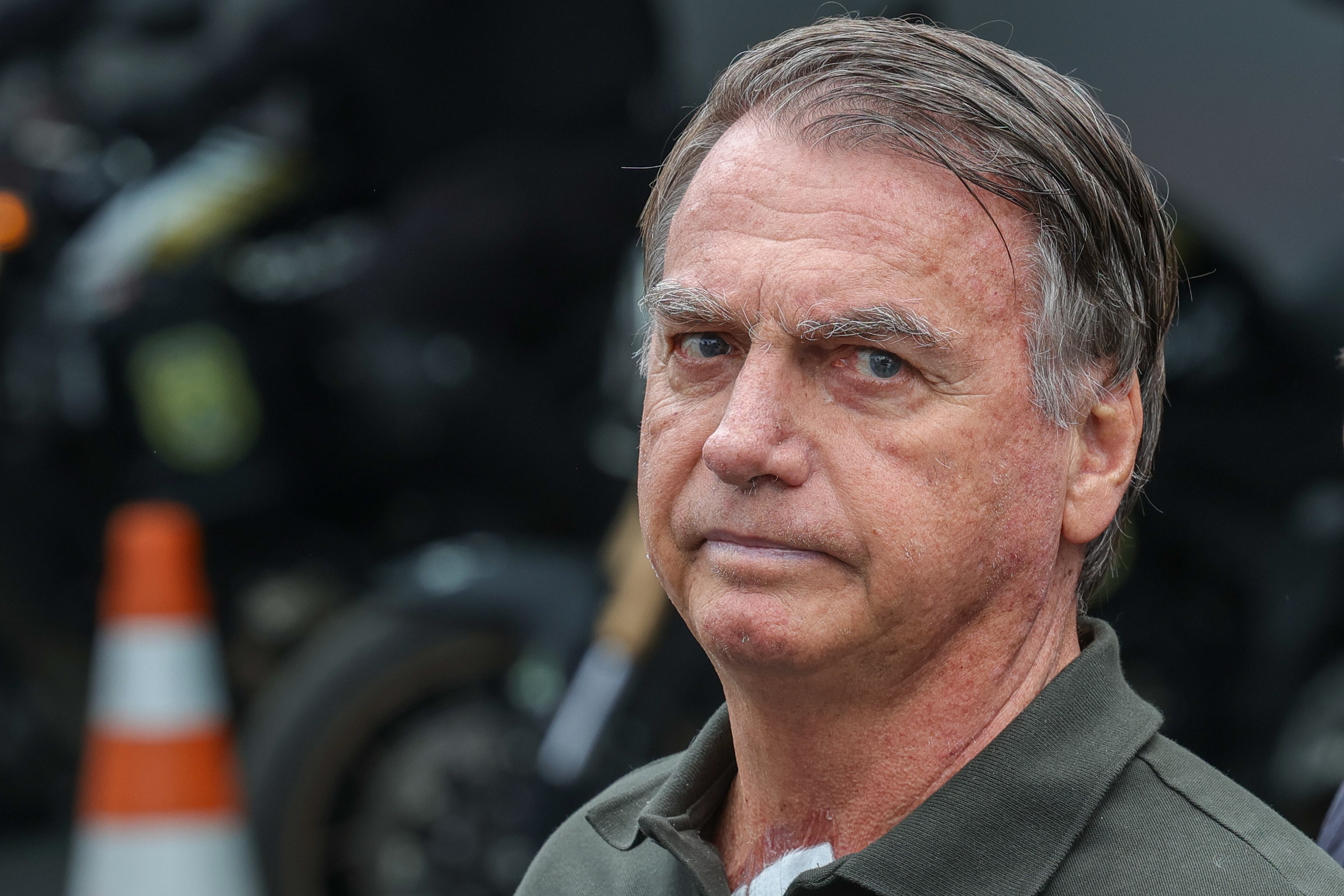 Boletim médico aponta melhora de Bolsonaro no ombro; pulmão permanece com  alteração – Noticias R7